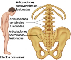 enfermedades reumaticas